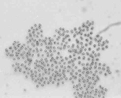 Microsystis aeruginosa - microscopic view, it looks like whole pepper sliced in two surrounded by tiny dots